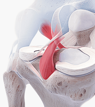 Ligamento cruzado anterior